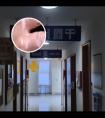 308准分子激光机器