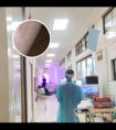 308纳米准分子光疗仪操作