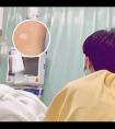 白癜风308遮挡布